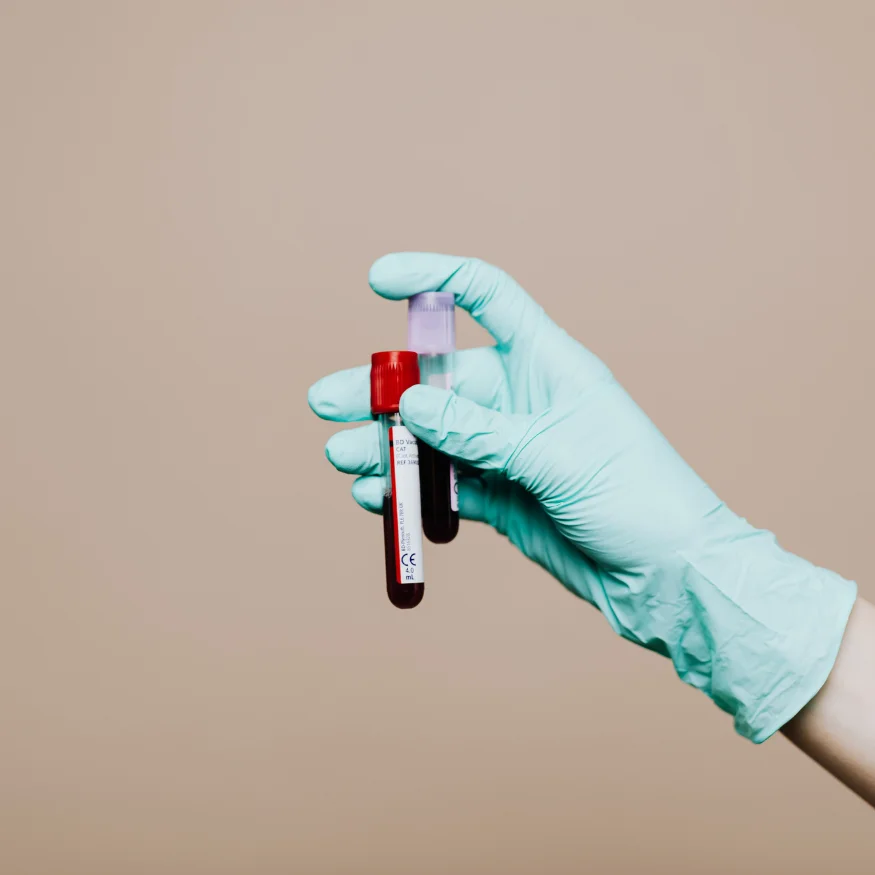 genetic examination, partner examination, preconception genetic testing, preimplantation genetic testing, PANDA, genetic test, genetic disorders, DNA, geneticist, genetics, genetic disorders, partner compatibility, PGT, PGT-A, PGT-M, chromosomes, euploidy, aneuploidy, miscarriage, recurrent miscarriages, hereditary diseases